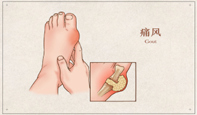 尿酸高吃什么好？饮食宜忌清单来啦！