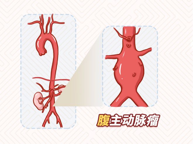 下载 (2)